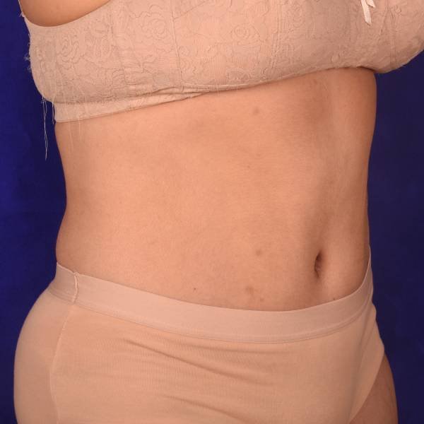 after image