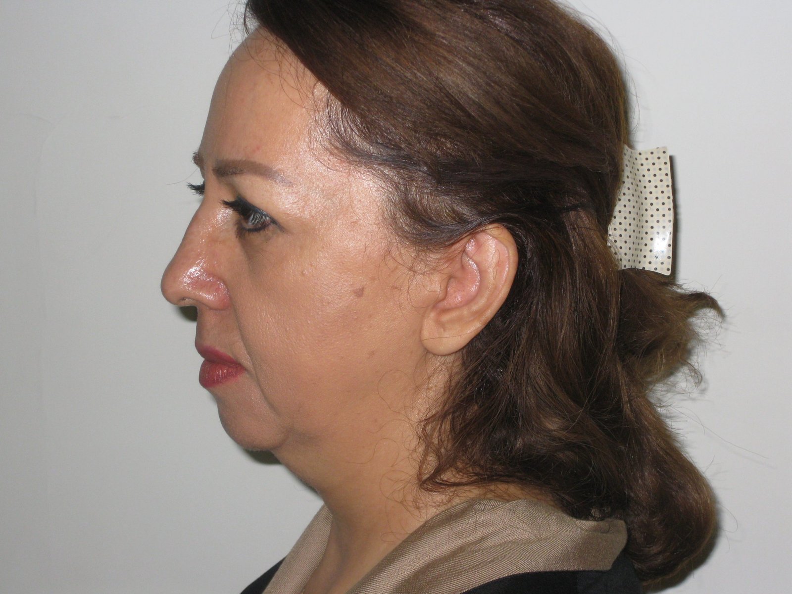 before Image